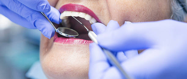 Best Emergency Dentist for Knocked-Out Tooth in Tallapoosa, GA