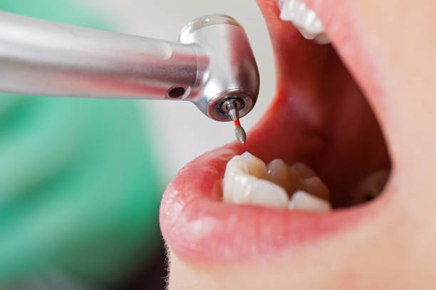 Best Broken or Cracked Tooth Emergency Dentist in Tallapoosa, GA